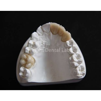 Dental PFM/ Zirconia / Metal Crowns Supplies