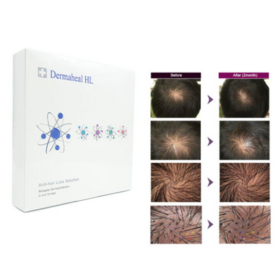Dermaheal HL dermal fillers hair regrowth skin rejuvenating hair follicles dermaheal mesotherapy