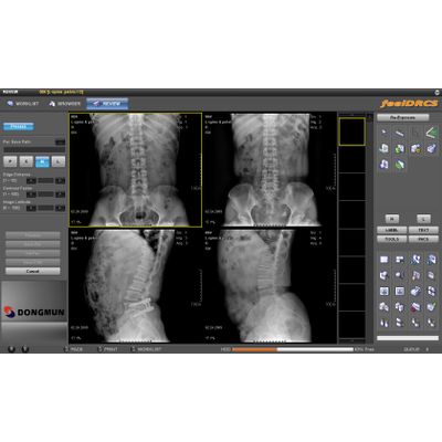 Digital X-ray Imaging Solution