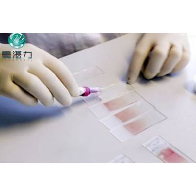 breathable latex disposable gloves for medical exam&breathable latex gloves