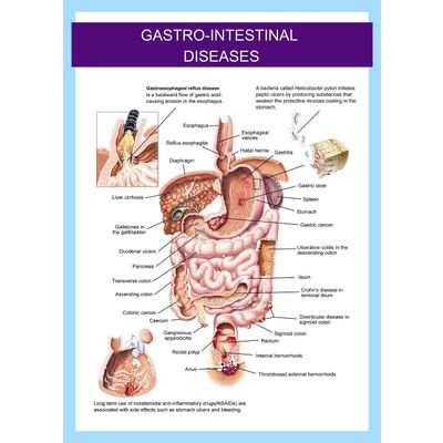 3D Medical Chart--gastro-intestinal Disease - Medfriend Co., Ltd