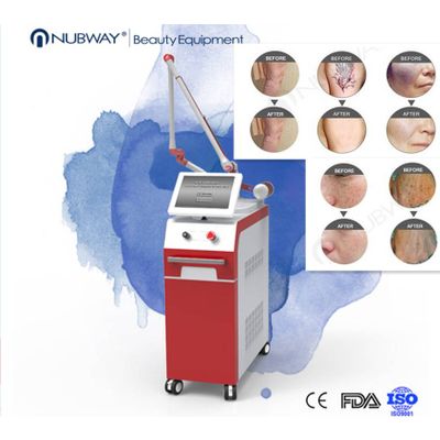 1064nm 532 nm 1320nm Pigment removal,Tattoo removal,Skin rejuvenation,Hair removal Q Switched Nd Yag