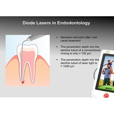 BERYLAS Diode Laser Dental Cuts Through Bone Gums And Any Other Tissues