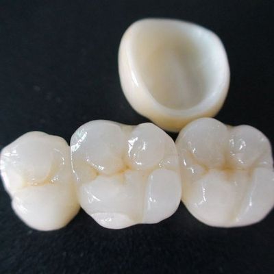 Dental valplast denture & acrylic denture & dental prosthesis