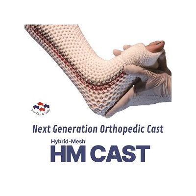HM CAST (Next Generation Orthopedic Cast)