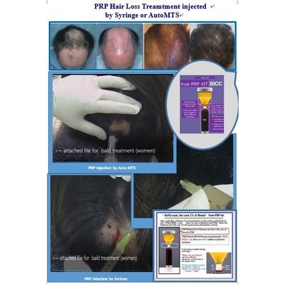 PRP Kit / Aesthetic / Hair Loss /