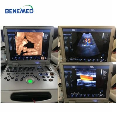 15"LED Medical Monitor Color Doppler Portable Type Ultrasound Scanner