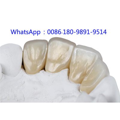 Zirconia Dental Crown | Zirconia Dental Lab in China
