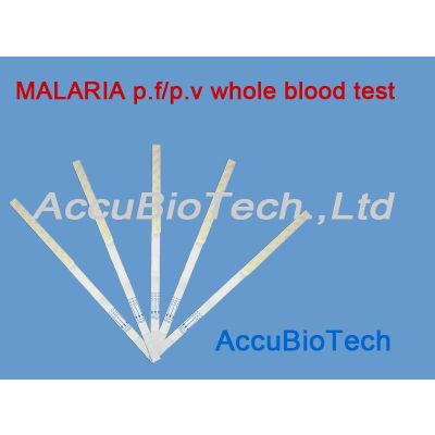 rapid malaria P.F/P.V whole blood test