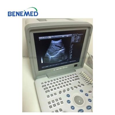 High Quality B/W Ultrasound Scanner with Clear Image Quality