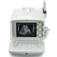 Sell Portable Ultrasound Scanner thumbnail image