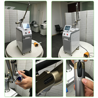 Q-switched nd yag tattoo laser removal machine with delicate design and korea imported light guide thumbnail image