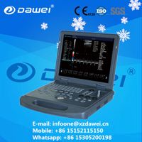 ultrasound machine portable&equipos de ultrasonido portatiles& ecografo DW-C60 thumbnail image