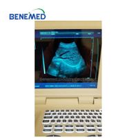 Notebook Type Black and White Ultrasound Scanner thumbnail image