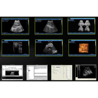 ultrasoud scanenr DP-50 thumbnail image