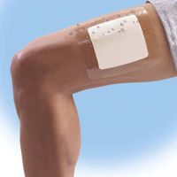 Waterproof Surgical Wound Dressing thumbnail image
