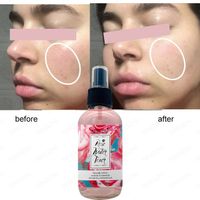 Low moq Face Skin Care Moisturizing Hydrating Spray Mist 100% Pure Organic Natural Rose Water Facial thumbnail image