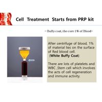 PRP KIT / Aesthetic / Skin rejuvenation / thumbnail image