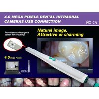 dental oral camera thumbnail image