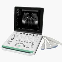 ultrasoud scanenr DP-50 thumbnail image