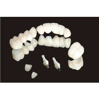 Zirconia Implant Porcelain Teeth thumbnail image